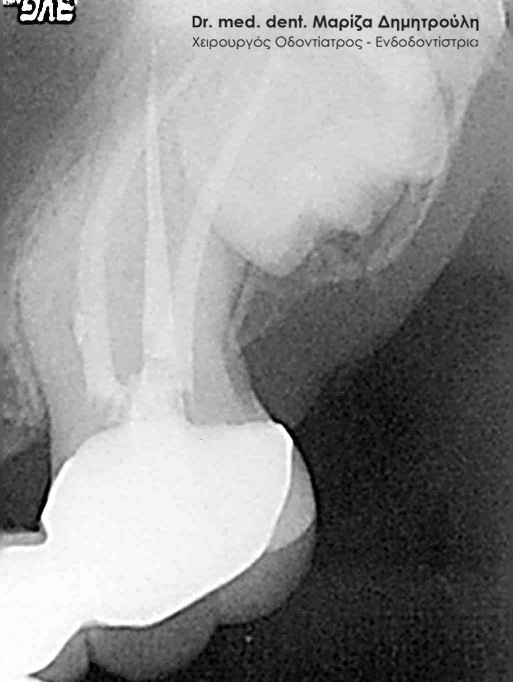 Κεκαμμενοι