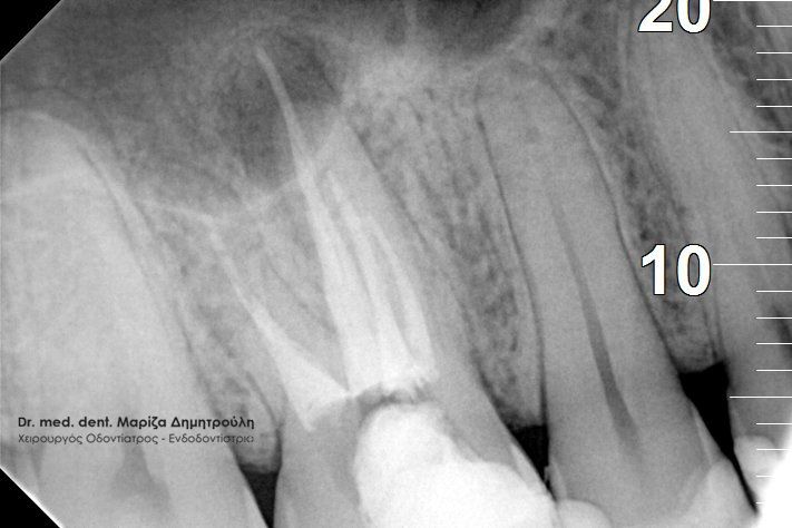 Κοντοπουλος μετα