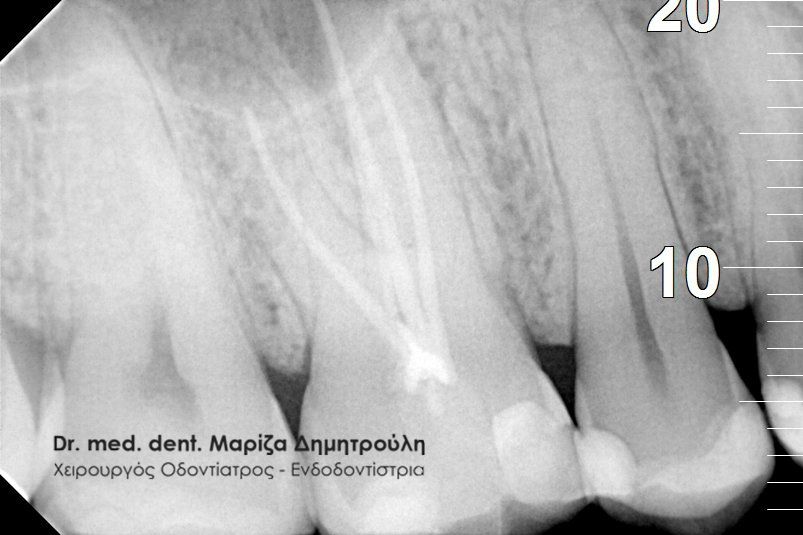 Κοντοπουλος πριν