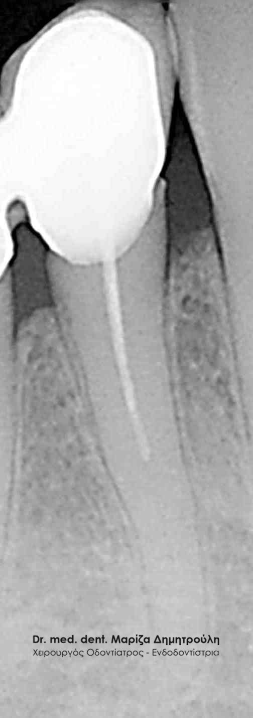 Πριν Χισεκορ