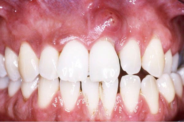 Ενδοδοντολόγος Θεσσαλονίκη