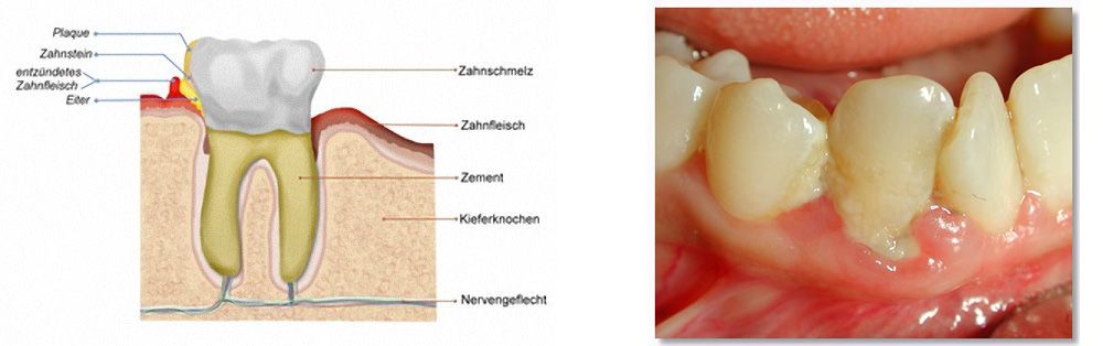 Ενδοδοντιστής Θεσσαλονίκη