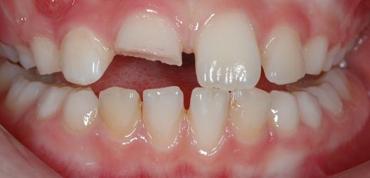 Ενδοδοντιστής Θέρμη