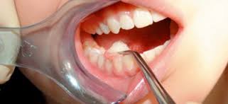 παιδοδοντίατρος θεσσαλονικη